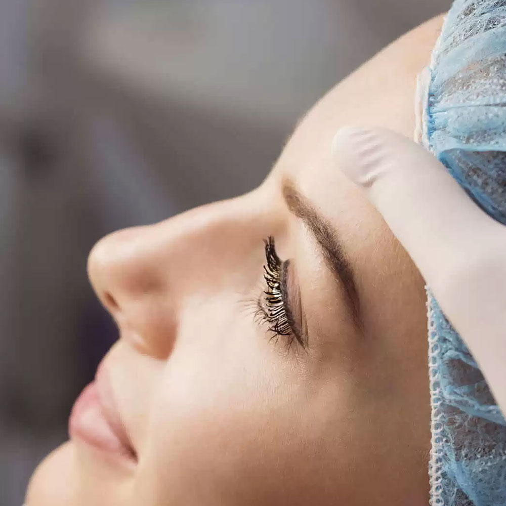 Rinoplastia